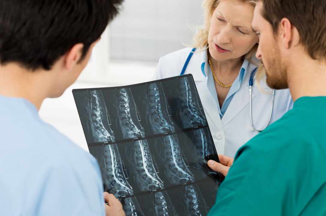 Osteochondrosis -Diagnose